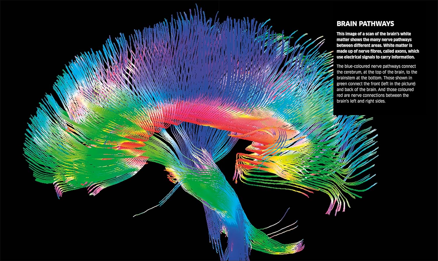 Knowledge Encyclopedia Human Body! (Knowledge Encyclopedias) Hardcover - Lets Buy Books